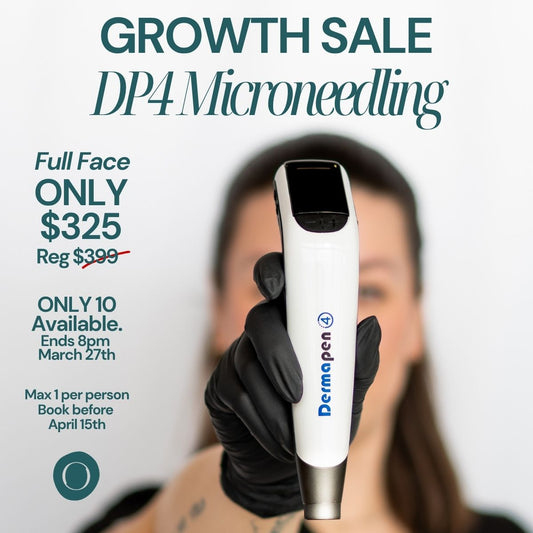 March FLASH Sale - DP4 Full Face Microneedling (One Per Person)